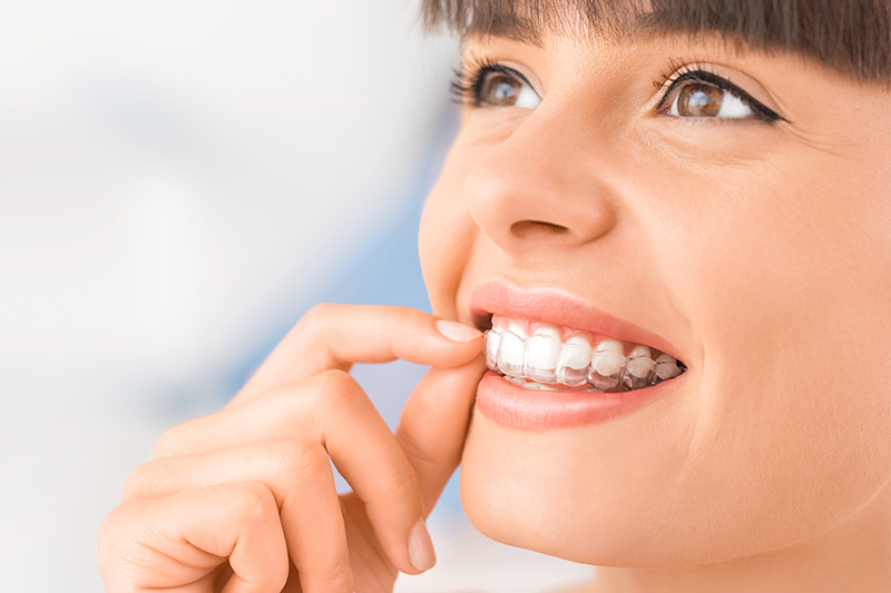 Invisalign in Evanston